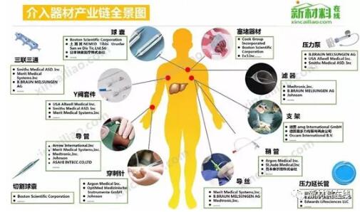 1.jpg 中國介入器械產(chǎn)品發(fā)展報告(附產(chǎn)業(yè)鏈全景圖)-肽度TIMEDOO