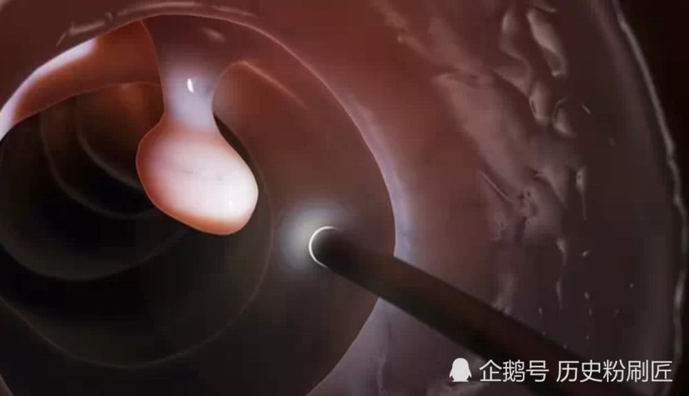 百年抗癌史:人類從來(lái)就沒有停止對(duì)癌癥探索的腳步-肽度TIMEDOO