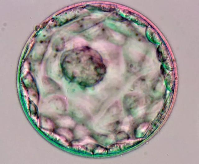 迄今最大規(guī)模研究發(fā)現(xiàn)，試管嬰兒總體患癌率比自然受孕嬰兒高出約17%-肽度TIMEDOO