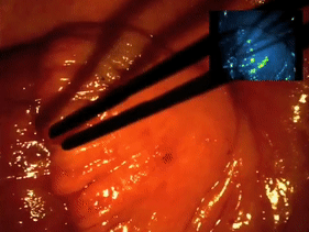 醫(yī)學(xué)“黑科技”來襲:靶向熒光探針-肽度TIMEDOO