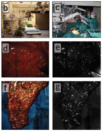 醫(yī)學(xué)“黑科技”來襲:靶向熒光探針-肽度TIMEDOO