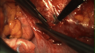 醫(yī)學(xué)“黑科技”來襲:靶向熒光探針-肽度TIMEDOO