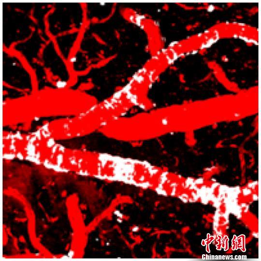 中國科學(xué)家揭示延緩阿爾茨海默病發(fā)病的新機制-肽度TIMEDOO