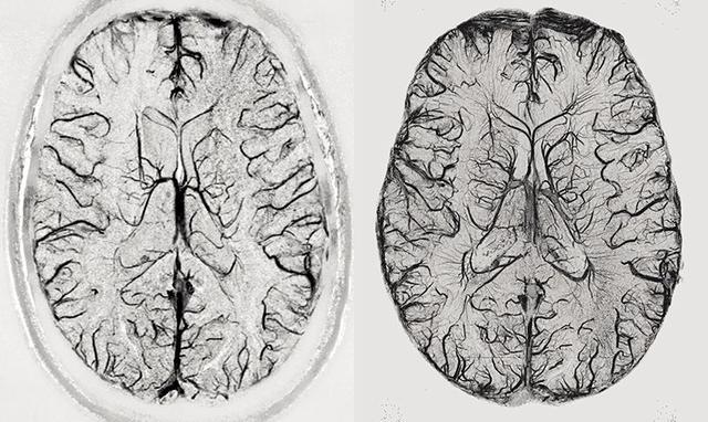 麻省總醫(yī)院出爐迄今最完整人類大腦三維圖像，數(shù)據(jù)集超過8TB-肽度TIMEDOO