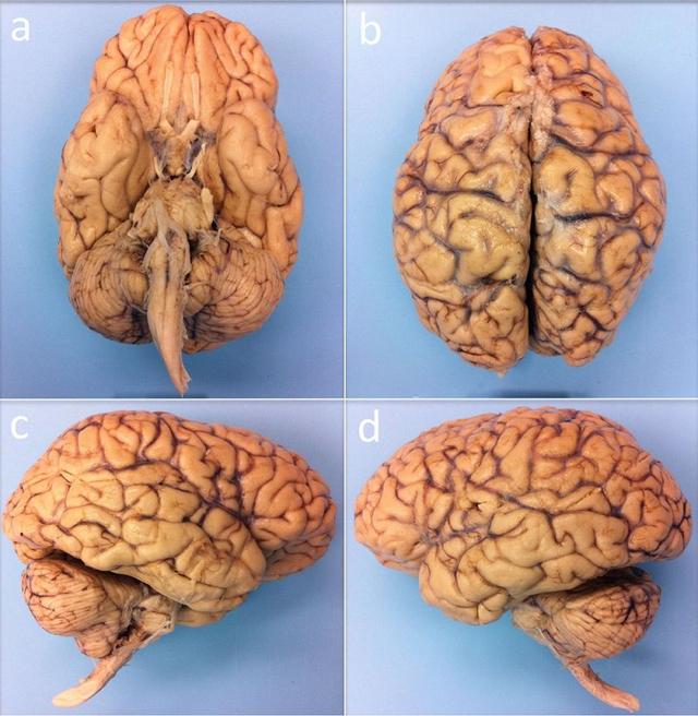 麻省總醫(yī)院出爐迄今最完整人類大腦三維圖像，數(shù)據(jù)集超過8TB-肽度TIMEDOO
