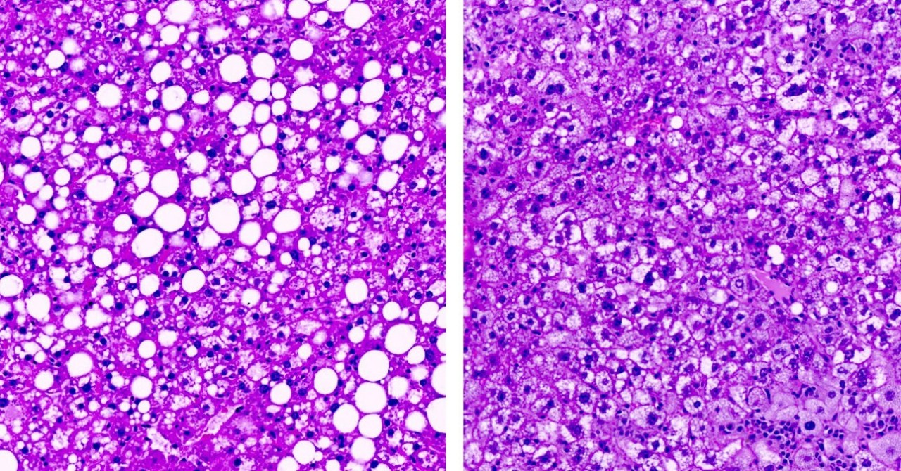 Science重磅：神奇分子，讓你“瞎吃不胖”-肽度TIMEDOO