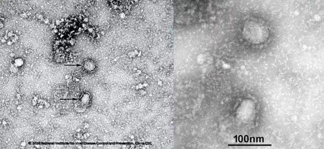 無癥狀病例已現(xiàn)！是誰把新冠病毒帶到武漢？科學(xué)家加速病毒溯源-肽度TIMEDOO