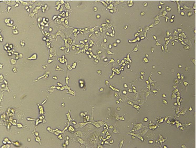 省疾控中心成功分離到廣東首株新型冠狀病毒毒株-肽度TIMEDOO