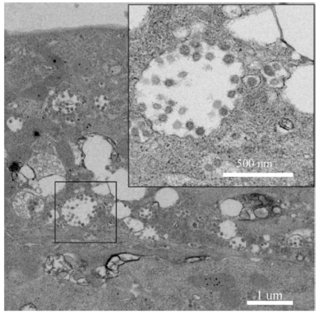 武漢病毒所/生物安全大科學(xué)中心揭示新型冠狀病毒(2019-nCoV)或來源于蝙蝠-肽度TIMEDOO