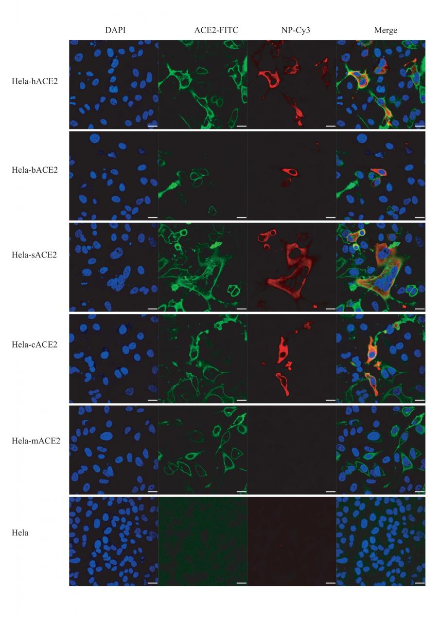 武漢病毒所/生物安全大科學(xué)中心揭示新型冠狀病毒(2019-nCoV)或來源于蝙蝠-肽度TIMEDOO
