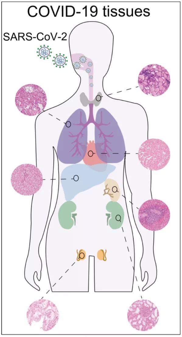 西湖大學(xué)繪制首張新冠患者多器官分子病理全景圖，死亡患者睪丸組織10個(gè)蛋白明顯改變-肽度TIMEDOO