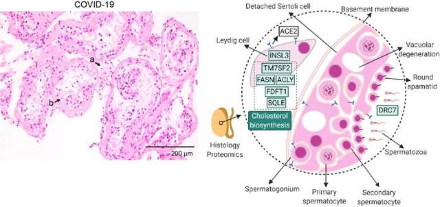 西湖大學(xué)繪制首張新冠患者多器官分子病理全景圖，死亡患者睪丸組織10個(gè)蛋白明顯改變-肽度TIMEDOO
