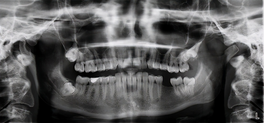 手機(jī)將能拍X光片！福州大學(xué)團(tuán)隊(duì)研發(fā)出柔性X射線(xiàn)成像技術(shù)，曾兩次登上Nature | 專(zhuān)訪-肽度TIMEDOO