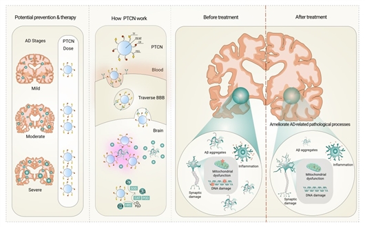 新型納米藥物有望防治阿爾茨海默病-肽度TIMEDOO