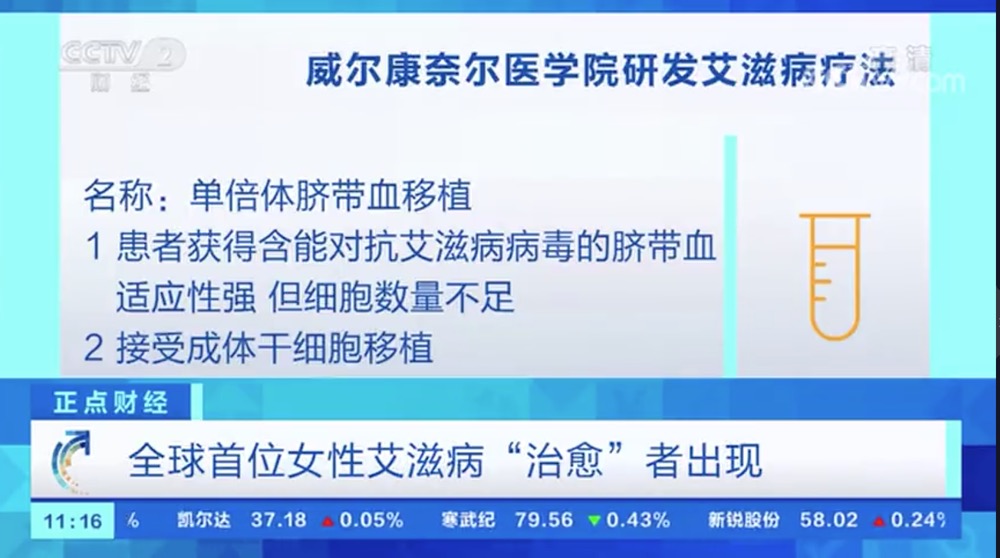 利用臍帶血干細(xì)胞療法 全球首位女性艾滋病“治愈”者出現(xiàn)-肽度TIMEDOO