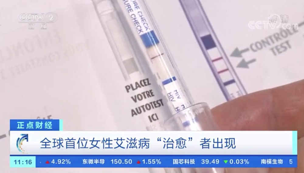 利用臍帶血干細(xì)胞療法 全球首位女性艾滋病“治愈”者出現(xiàn)-肽度TIMEDOO