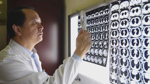 專家：免疫治療對1/3晚期肺癌患者效果顯著，可延長生存期-肽度TIMEDOO