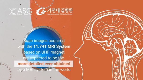 The world’s first simultaneous multi-channel/multi-nuclear 11.74T MRI system is currently under development at Gachon University Gil Medical Center with ASG Superconductors 最具創(chuàng)新性11.74T核磁共振磁芯將用于人體-肽度TIMEDOO