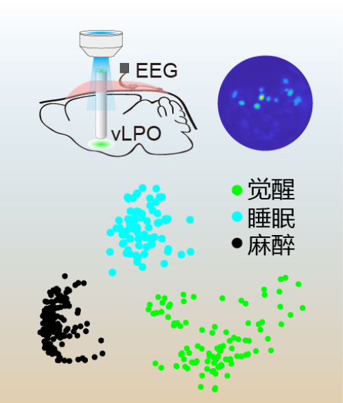 腦智卓越中心等發(fā)現(xiàn)全身麻醉對睡眠核心網(wǎng)絡(luò)的調(diào)控規(guī)律-肽度TIMEDOO