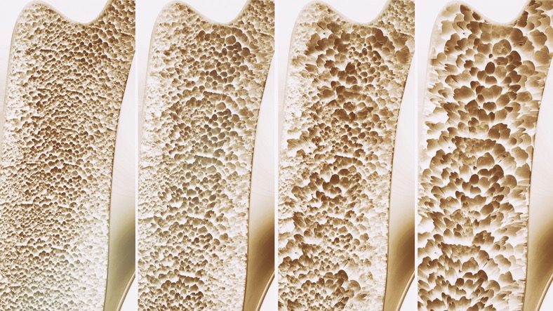 道微生物與骨骼健康的秘密:骨微生物學(xué)的新發(fā)現(xiàn)-肽度TIMEDOO