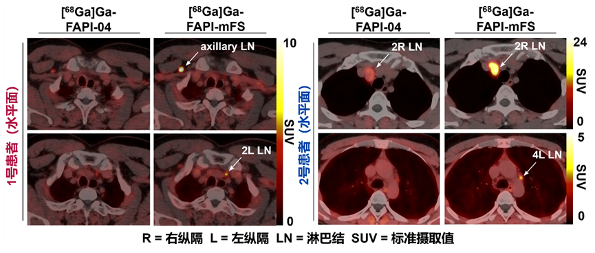 北京大學(xué)劉志博團(tuán)隊(duì)在《自然》發(fā)文報(bào)道靶向共價(jià)放射性藥物-肽度TIMEDOO
