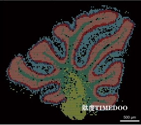 孤獨(dú)癥相關(guān)基因研究有了新進(jìn)展-肽度TIMEDOO