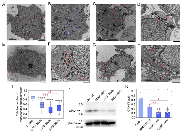 研究人員揭示SOD1病理突變體激活細(xì)胞鐵死亡并誘發(fā)家族遺傳型ALS新機(jī)制-肽度TIMEDOO