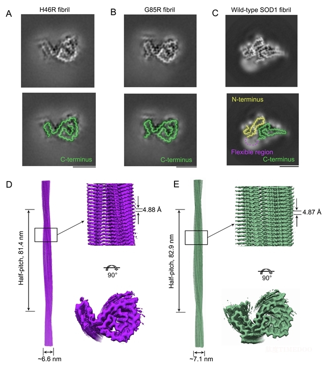 研究人員揭示SOD1病理突變體激活細(xì)胞鐵死亡并誘發(fā)家族遺傳型ALS新機(jī)制-肽度TIMEDOO