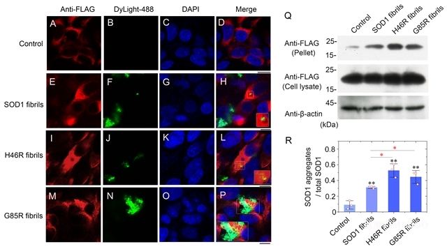 研究人員揭示SOD1病理突變體激活細(xì)胞鐵死亡并誘發(fā)家族遺傳型ALS新機(jī)制-肽度TIMEDOO