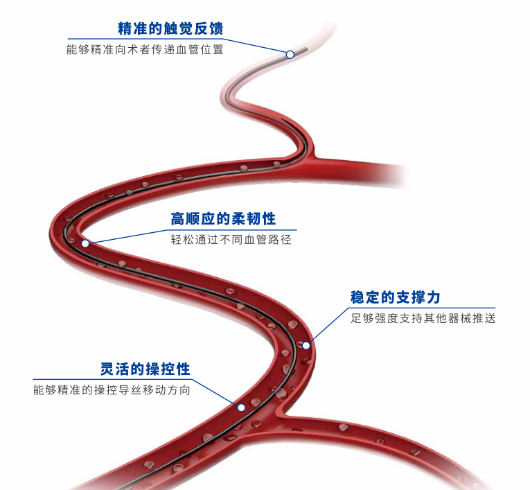 獲批上市！國(guó)產(chǎn)血管介入微導(dǎo)絲-肽度TIMEDOO