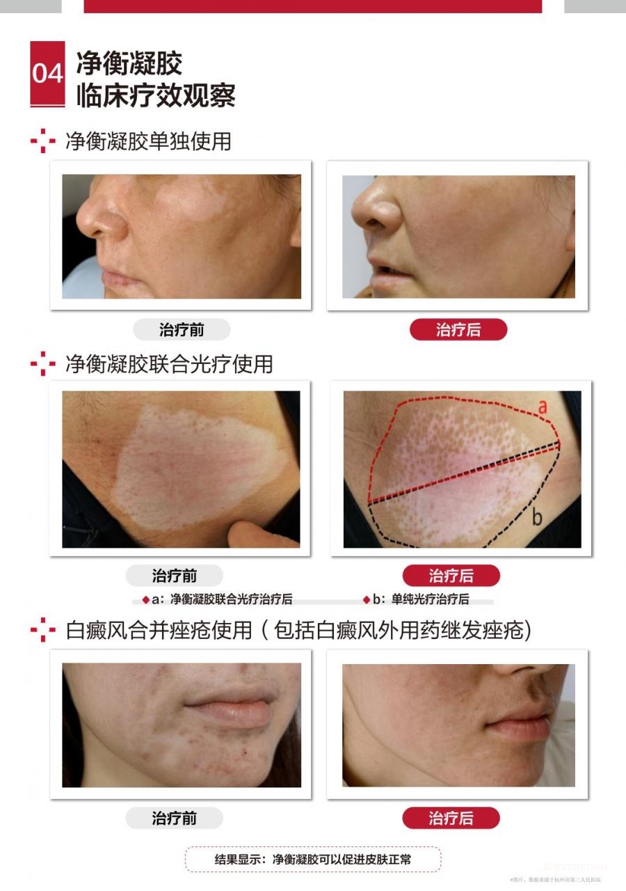 9.jpg 科學循證 凈衡無憂——凈衡凝膠新品上市會暨功效性護膚品學術研討會圓滿落幕-肽度TIMEDOO