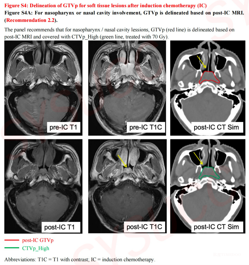 中國學(xué)者牽頭！鼻咽癌放療國際指南發(fā)布-肽度TIMEDOO