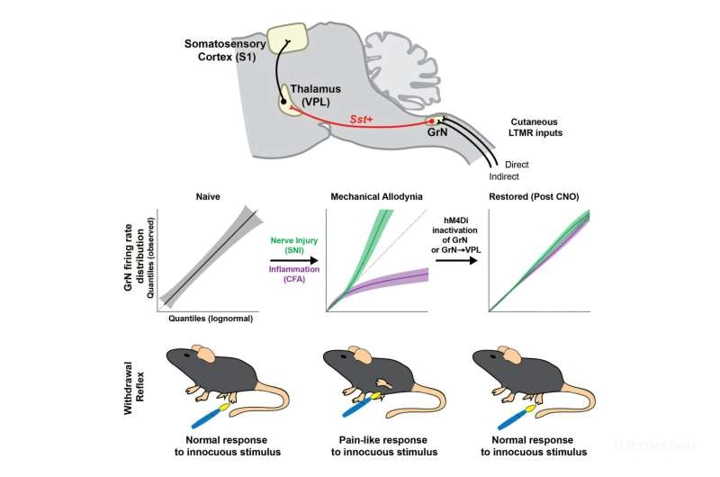 科學家揭示慢性疼痛新機制:輕觸也能變痛感-肽度TIMEDOO