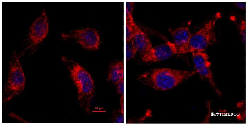 科學家揭示“冷”腫瘤背后基因突變，雷帕霉素或助免疫療法重新奏效-肽度TIMEDOO