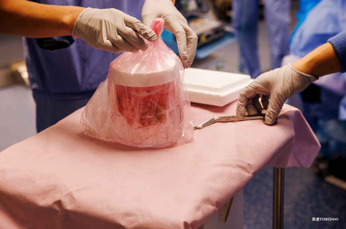 男子移植的豬腎在即將創(chuàng)下紀錄前衰竭，體內(nèi)存活近9個月-肽度TIMEDOO