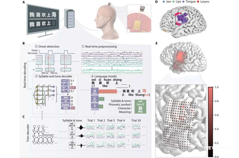 首次實(shí)現(xiàn)漢語實(shí)時腦機(jī)解碼！上海團(tuán)隊(duì)攻克聲調(diào)語言腦信號翻譯難題-肽度TIMEDOO