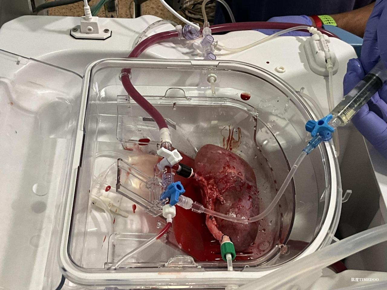 人腎類器官首次與豬腎實現(xiàn)功能整合-肽度TIMEDOO