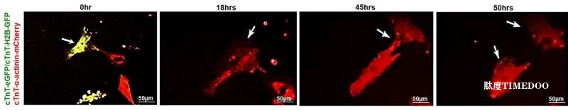 重啟“沉睡基因”，讓心臟自我修復(fù)——西奈山研究團(tuán)隊(duì)揭示Cyclin A2基因可再生成人心肌細(xì)胞-肽度TIMEDOO
