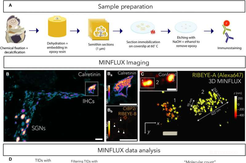 德國科學(xué)家首次繪制內(nèi)耳突觸“分子地圖”，揭示精準(zhǔn)聽覺的秘密-肽度TIMEDOO