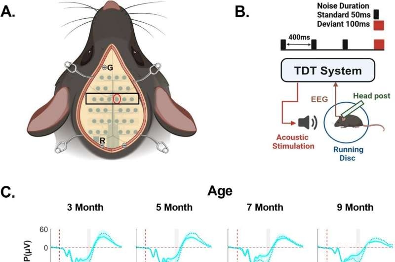 科學(xué)家發(fā)現(xiàn)性別差異性腦反應(yīng)機(jī)制，為巴滕?。–LN3型）治療研究提供新模型-肽度TIMEDOO